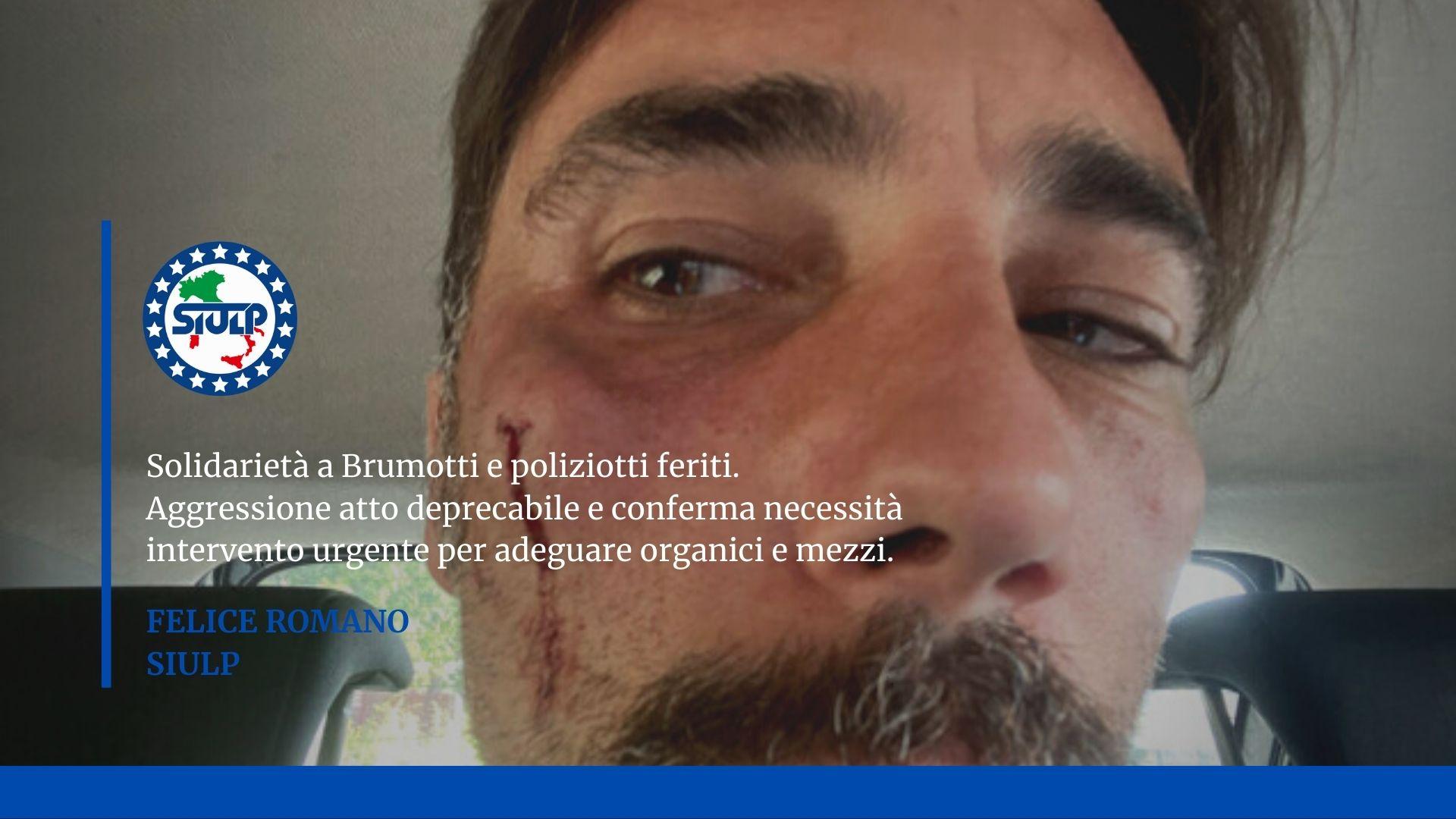 FOGGIA: solidarietà a Brumotti e poliziotti feriti.