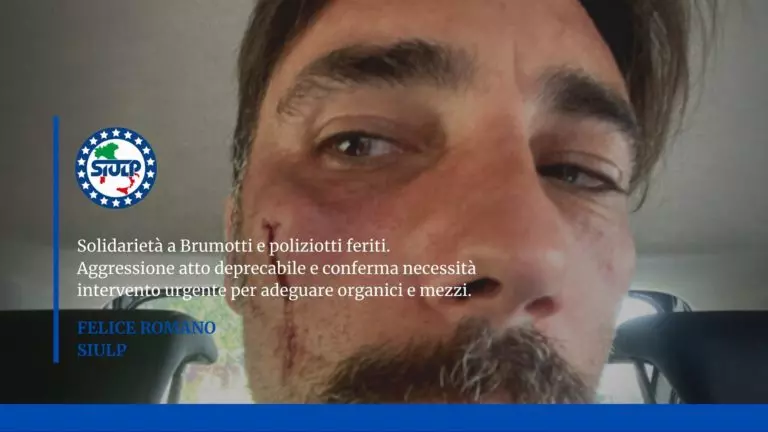 FOGGIA: solidarietà a Brumotti e poliziotti feriti.
